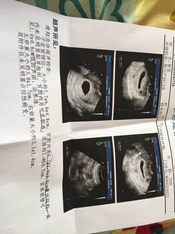journal_insert_pic_445329154