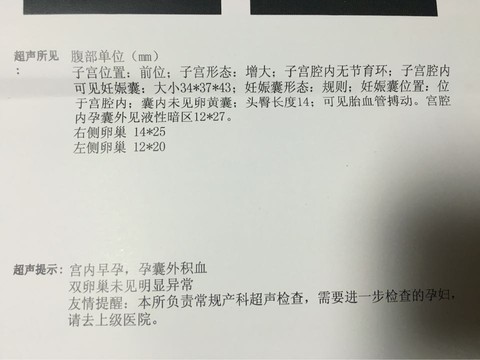 journal_insert_pic_446793652