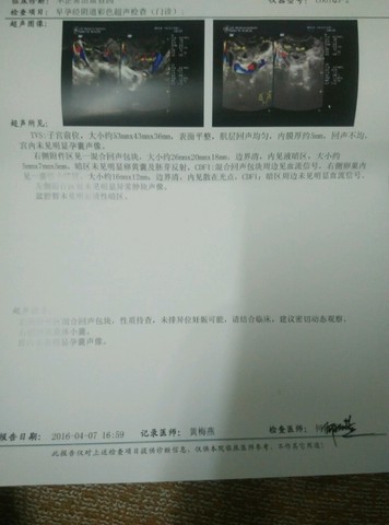 journal_insert_pic_446829567