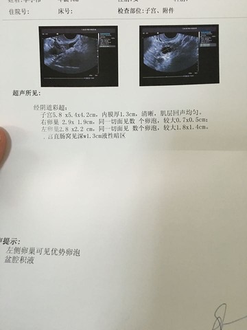 journal_insert_pic_448226868