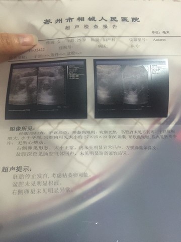journal_insert_pic_450220800