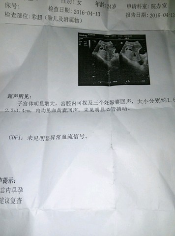 journal_insert_pic_451890212
