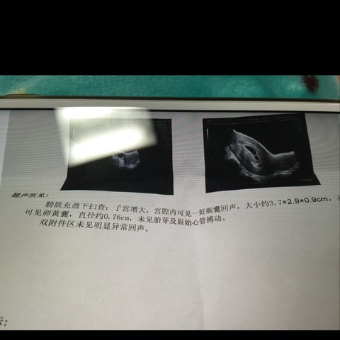 journal_insert_pic_451905005