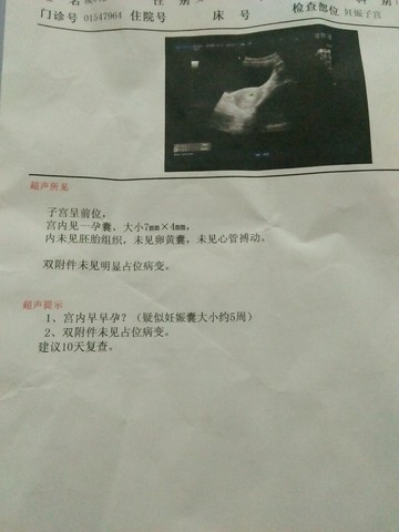 journal_insert_pic_452284082