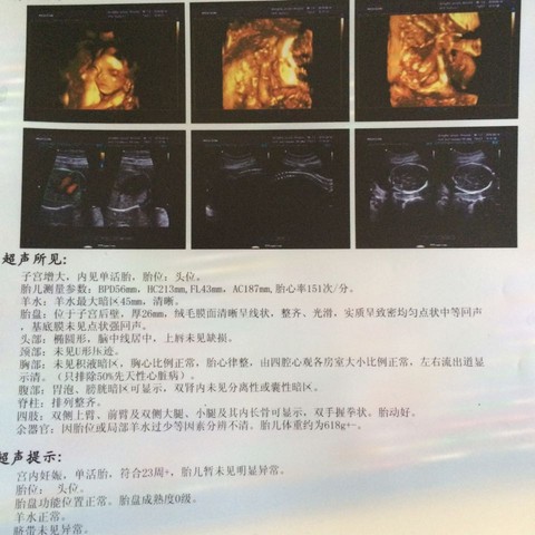 journal_insert_pic_453834457
