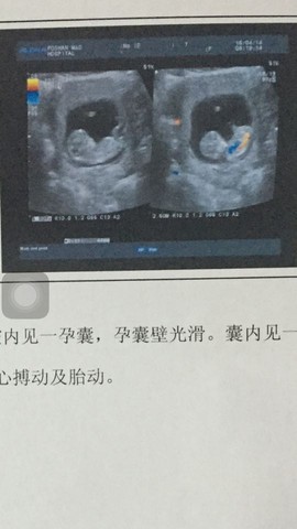 journal_insert_pic_454497921