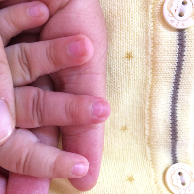 四个月宝宝手指甲有点白,是怎麼回事