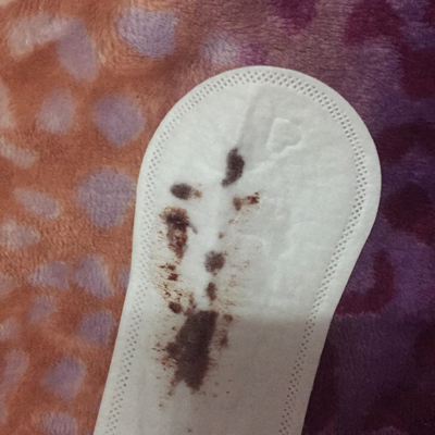 宝妈们我怀孕42天刚刚流出来很黑的血不知道要不要紧好害怕肚子不痛腰