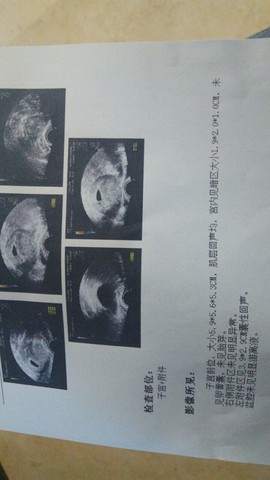 journal_insert_pic_456783984