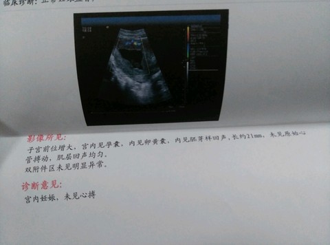journal_insert_pic_458946147