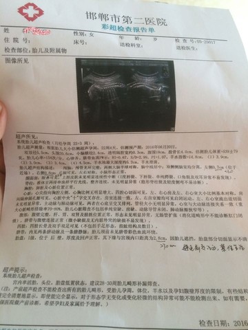 journal_insert_pic_460031276