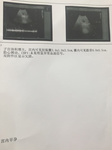 journal_insert_pic_460872384