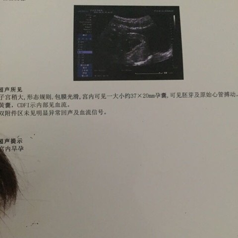journal_insert_pic_460580464