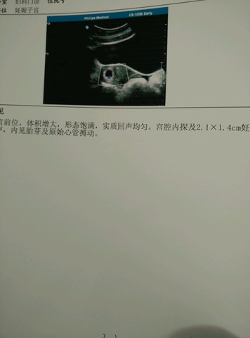 journal_insert_pic_460768883