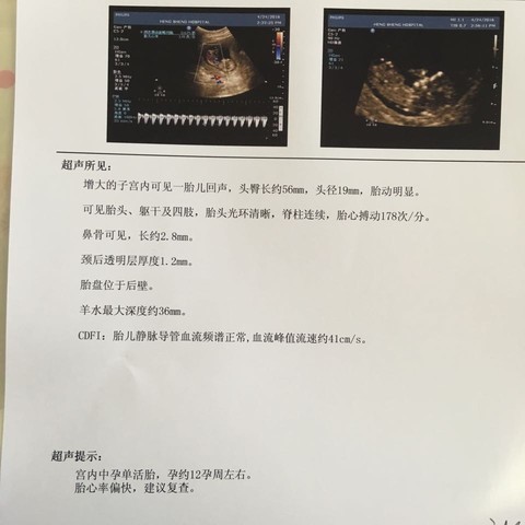 journal_insert_pic_462630456