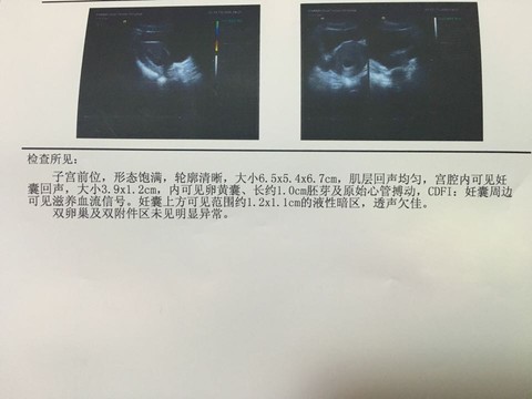 journal_insert_pic_462191108