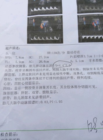 journal_insert_pic_462995000