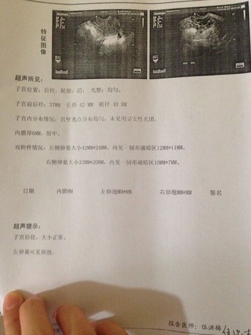 journal_insert_pic_463139718