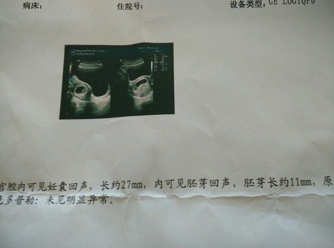 journal_insert_pic_464183172