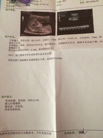 journal_insert_pic_464925230