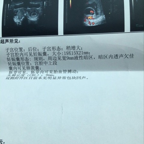 journal_insert_pic_465094371