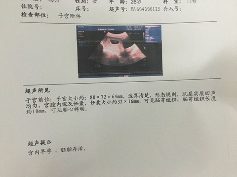journal_insert_pic_466098421