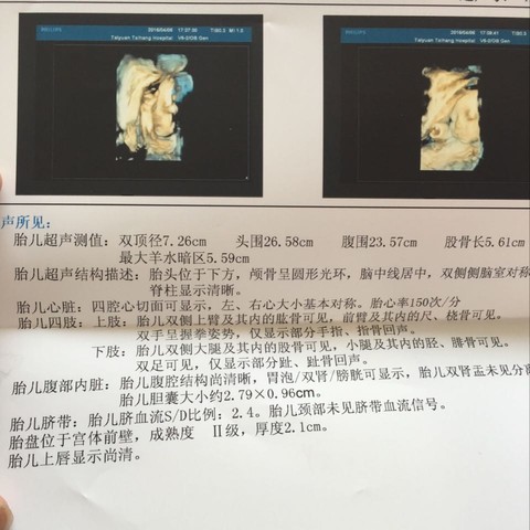journal_insert_pic_466559647