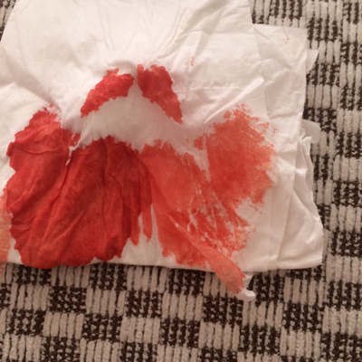 五天都是这样的情况,肚子一痛就出血,心裏压力很大