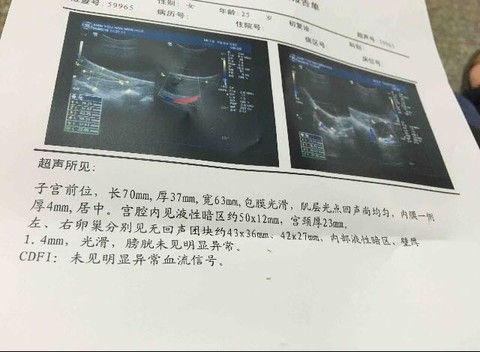 journal_insert_pic_470003028