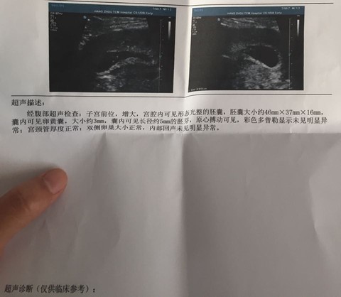 journal_insert_pic_471162970