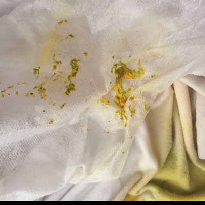 请问出生十天的宝宝最近解的大便是这种黄黄绿绿的小颗粒状的大便,是