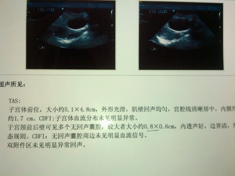 journal_insert_pic_473512913