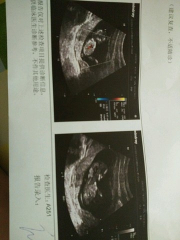 journal_insert_pic_473372762