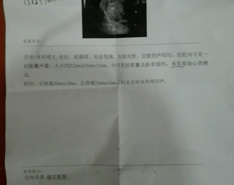 journal_insert_pic_474848736