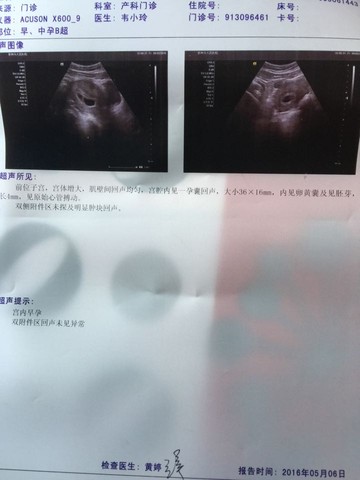 journal_insert_pic_474770702