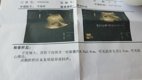 journal_insert_pic_475298734