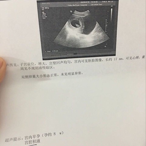 journal_insert_pic_475499562