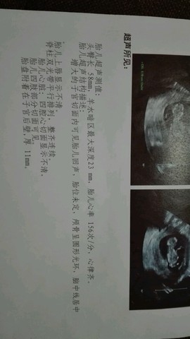 journal_insert_pic_476656597