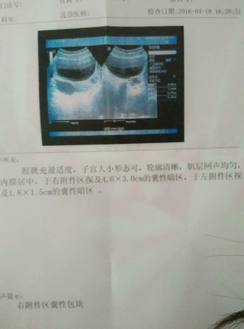 journal_insert_pic_477040330