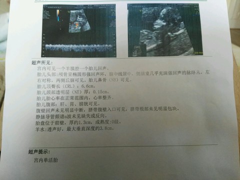 journal_insert_pic_480229372