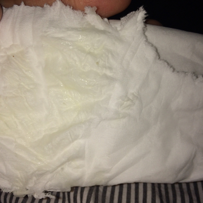 白带也变的多了.怎麼回事?