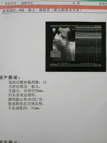journal_insert_pic_480746534