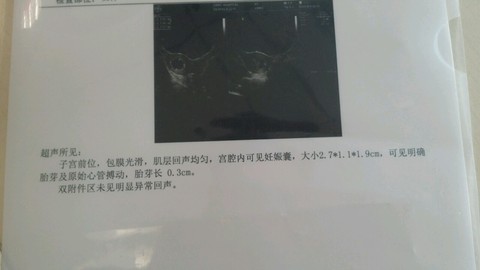 journal_insert_pic_482920849