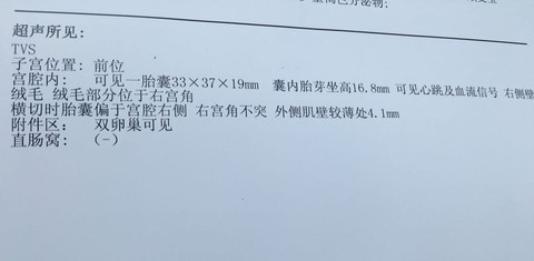 journal_insert_pic_483141508