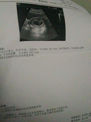 journal_insert_pic_483727166