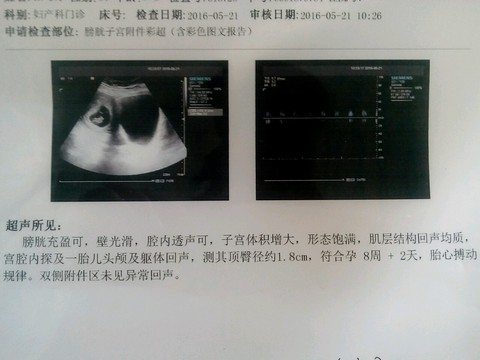 journal_insert_pic_484721368