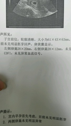 journal_insert_pic_485494855