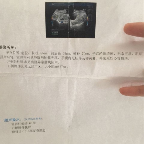 journal_insert_pic_486554627