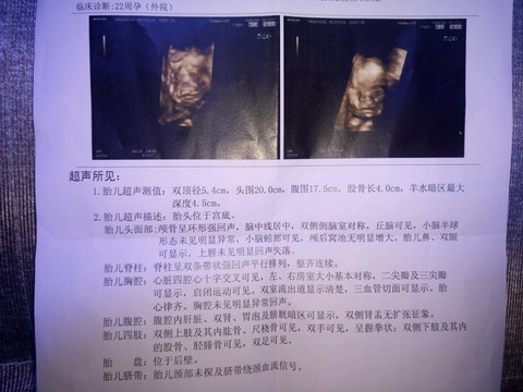 journal_insert_pic_488018792