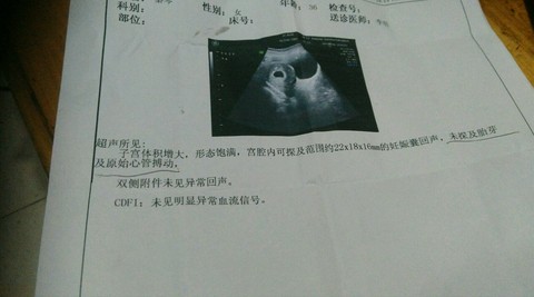 journal_insert_pic_487559330